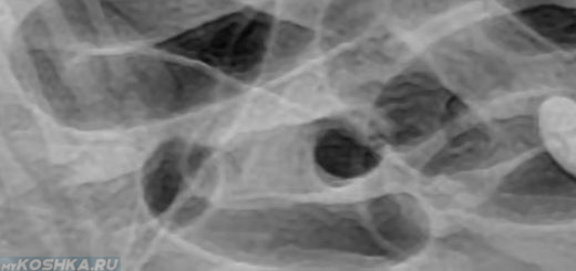 Рентген кишечной непроходимости у кота
