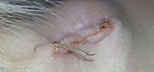 Шишка после операции под швом у кошки