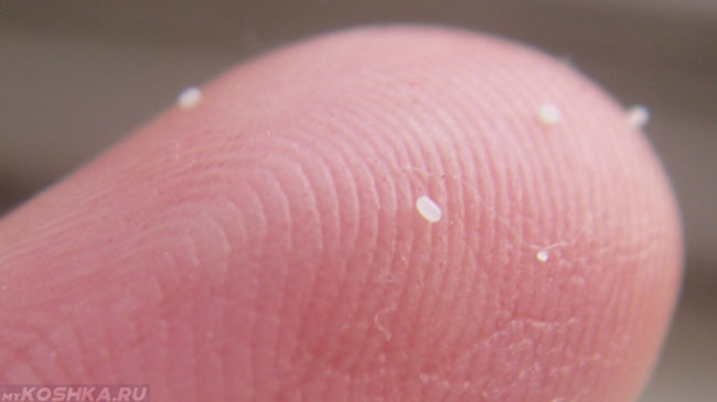 Белые личинки глистов на пальце человека