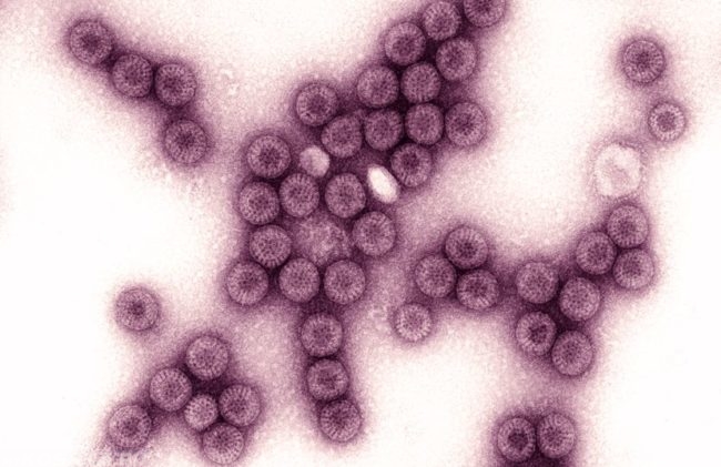 Вирус в увеличенном виде под микроскопом