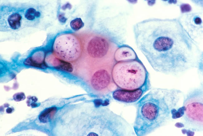 Микроб хламидия под микроскопом
