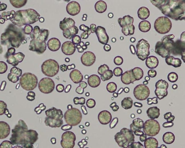 Кристаллы тирозина под микроскопом