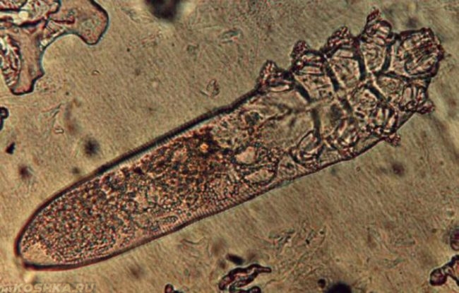 Подкожный клещ демодекс под микроскопом