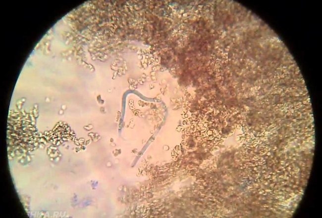 Микрофилярия под микроскопом