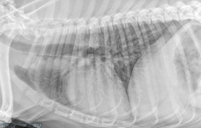 Отёк лёгких на рентгеновском снимке