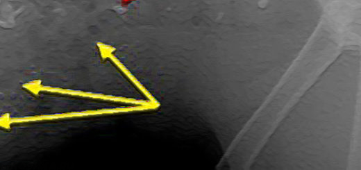 Застрявшая кость в кишечнике у собаки на рентгене