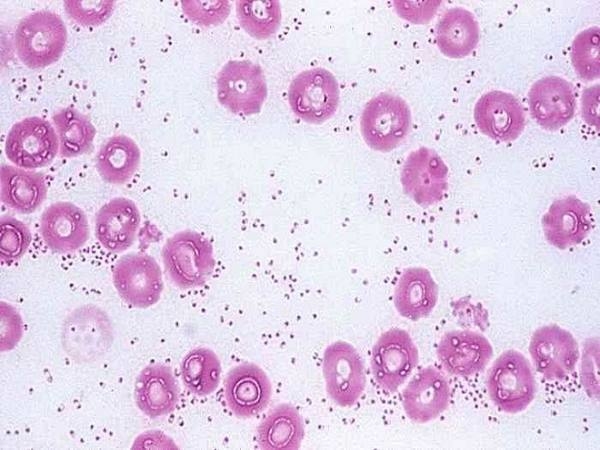 Снимок под микроскопом опасной бактерии Pasteurella, поражающей больных кроликов